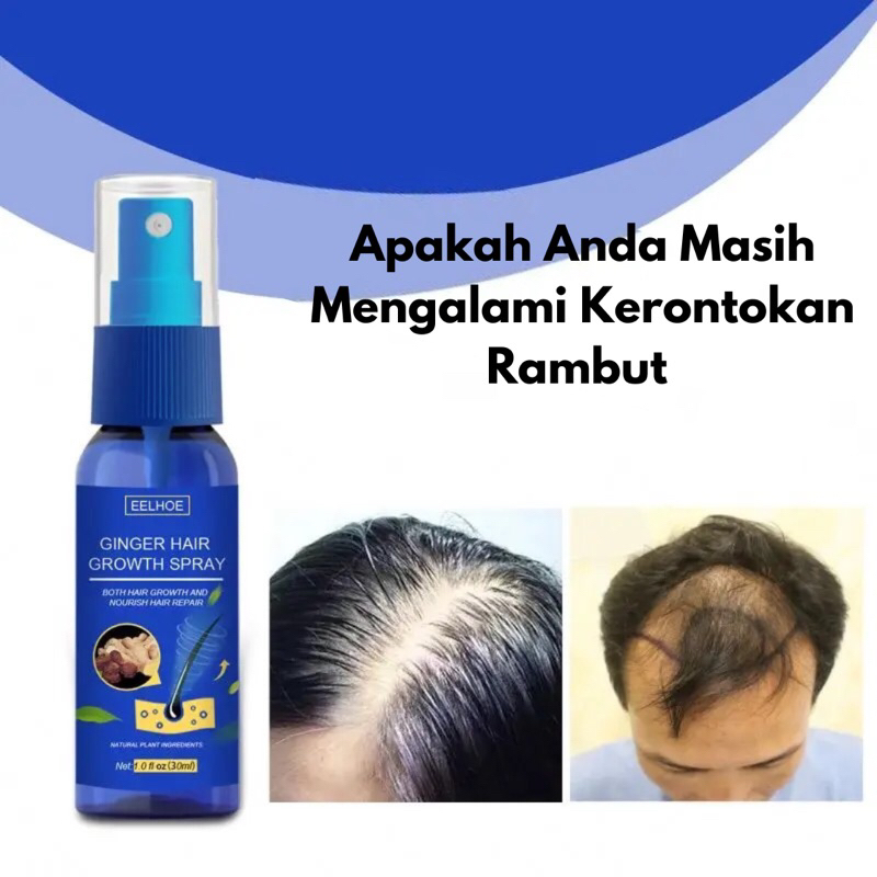 Minyak Spray Penumbuh Rambut Tipis Botak Cepat Efektif