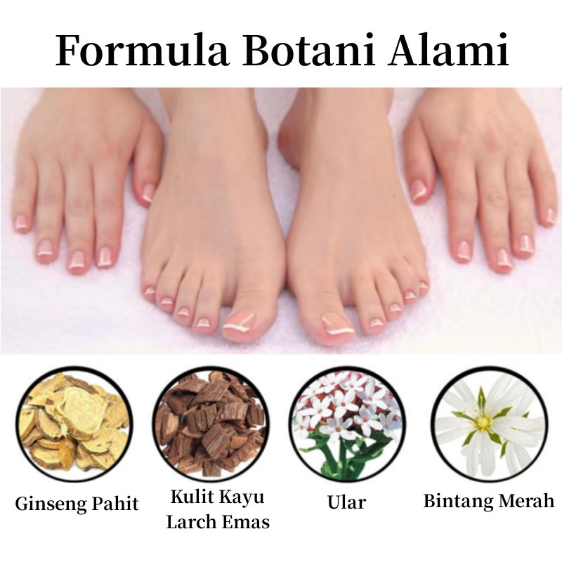 Obat Jamur Kuku Obat kuku jamur dan rusak Perawatan Kuku Berjamur Antibakteri Perawatan Kuku Onikomikosis Paronychia Anti Infeksi Kuku Toe Nail Pengobatan Jamur Minyak Nail Repair Essence Serum