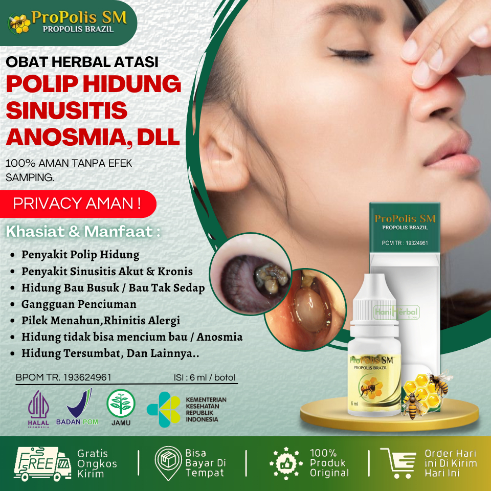 Obat Herbal Untuk Polip Hidung, Obat Untuk Penyakit Polip Hidung, Obat Untuk Menghilangkan Polip Hid