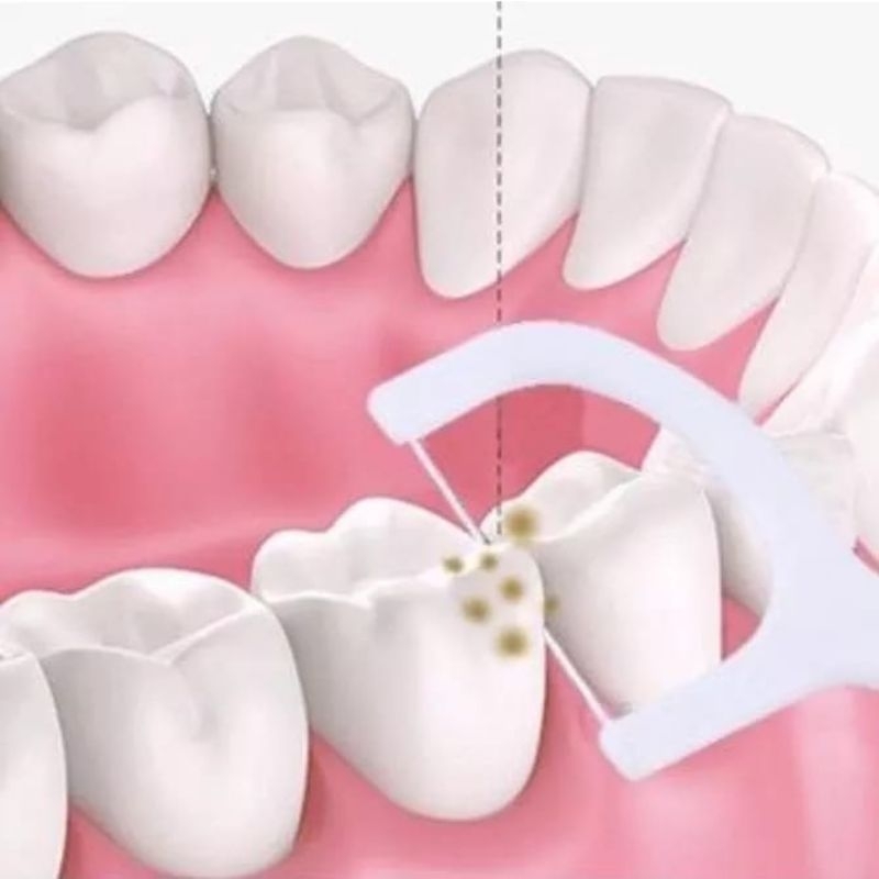 Benang Gigi / Dental Floss / Pembersih Gigi / Tusuk Gigi / Pembersih Sela Gigi Higienis