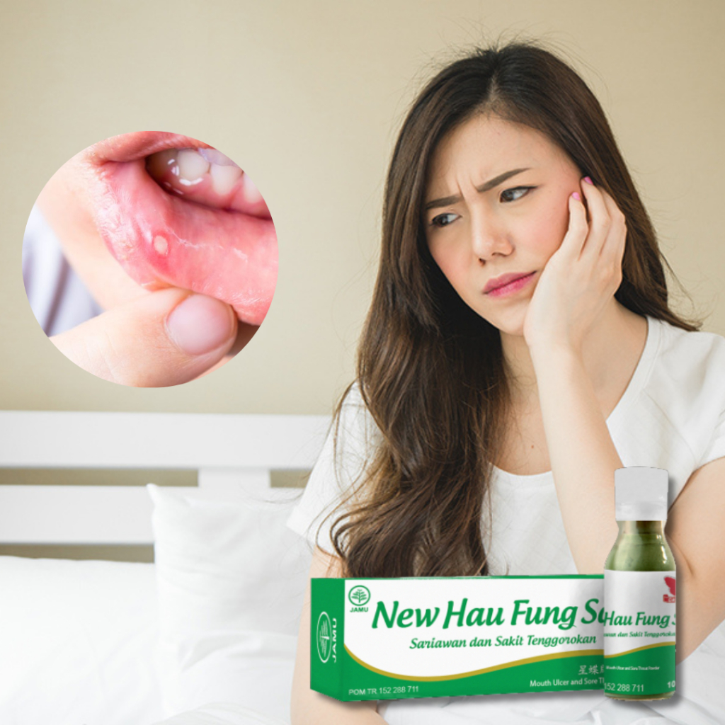 obat sariawan, obat untuk menyembuhkan sariawan bibir , serbuk herbal untuk menyembuhkan sariawan di
