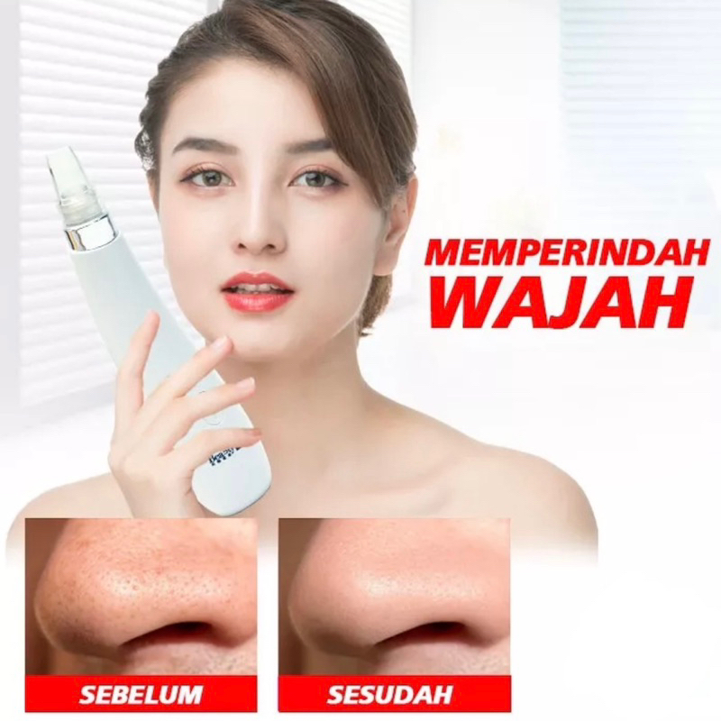 Alat Penyedot Komedo Jerawat Elektrik Comedo Blackhead Comedone Remove