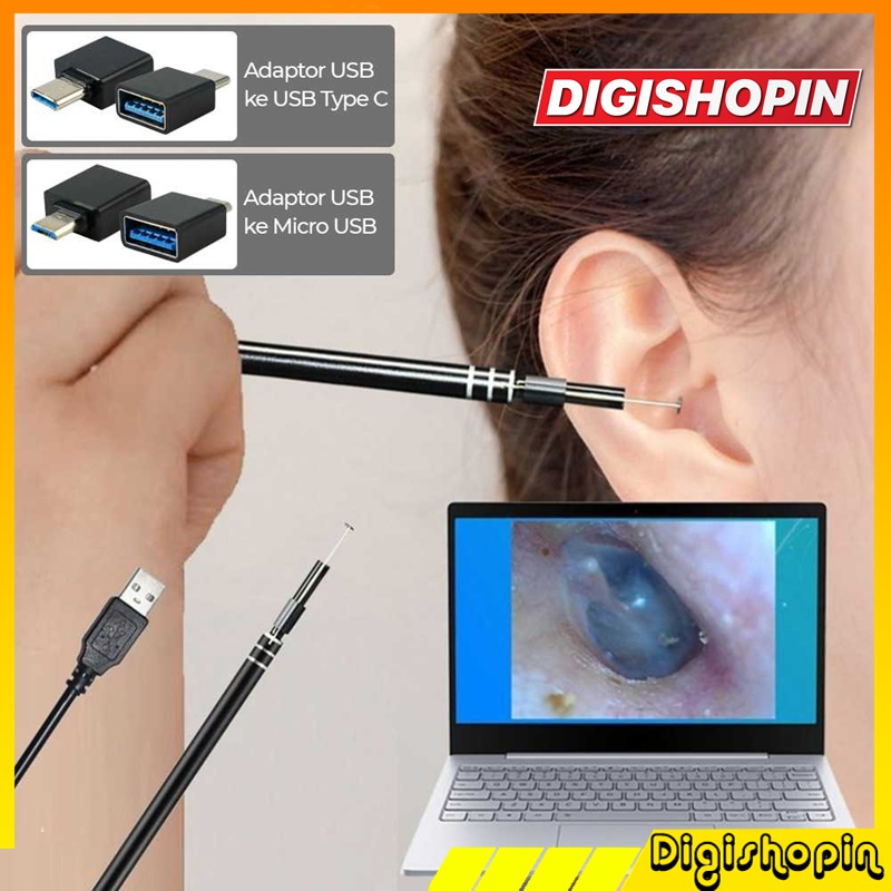 Korek Kuping Dengan Kamera Endoscope HD 6 LED Type C Pembersih Telinga
