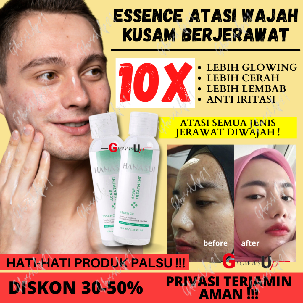 HANASUI ACNE TREATMENT ESSENSE 100ML BPOM - TREATMENT ESSENSE HANASUI