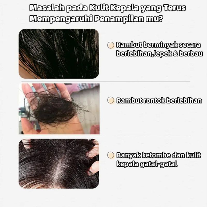 AUROR REMIMPI SHAMPOO TREATMENT OIL CONTROL PENUMBUH RAMBUT