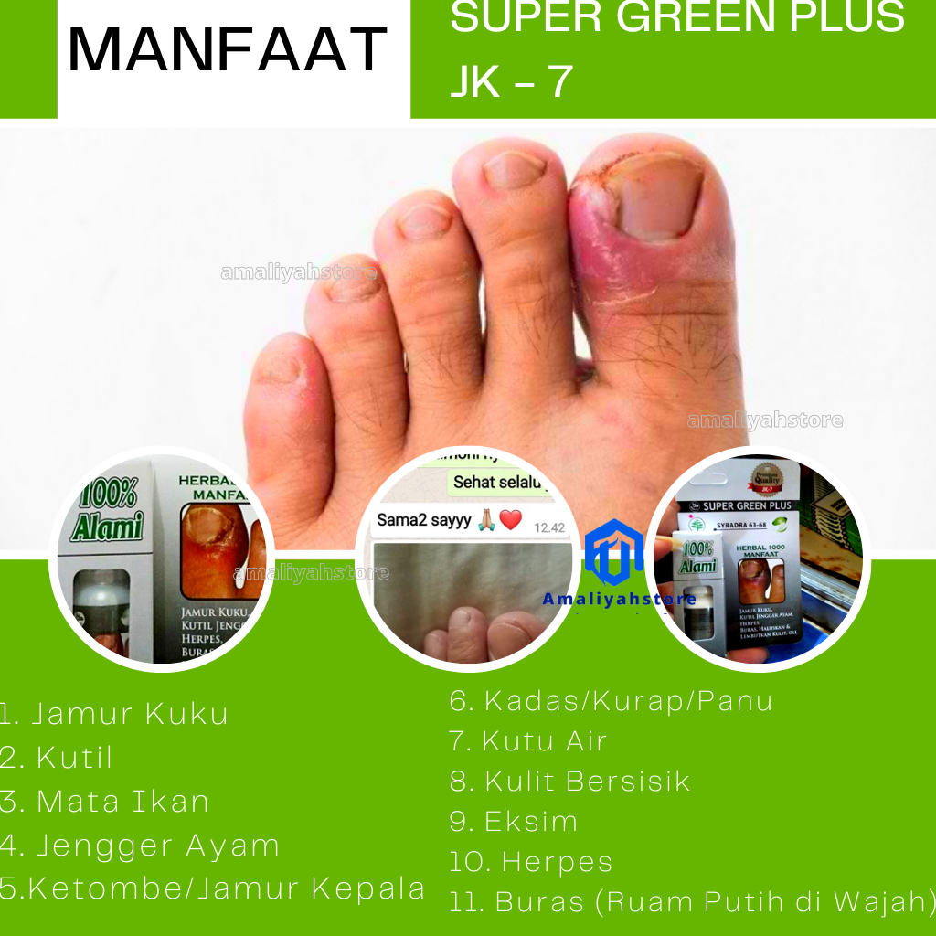 Super Green Plus Jk7 Obat Cantengan Jamur Kuku Penghalus Kulit Jempol Kaki Bersisik Kasar Pelembut Kulit Anti Kutil Mata Ikan Penghilang Ketombe Rambut 100% Original