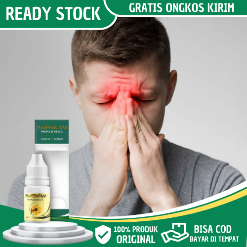 Obat Sinusitis, Sinusitis Akut Parah, Sinusitis Kronis, Sinusitis Menahun, Hidung Tersumbat, Pilek, 