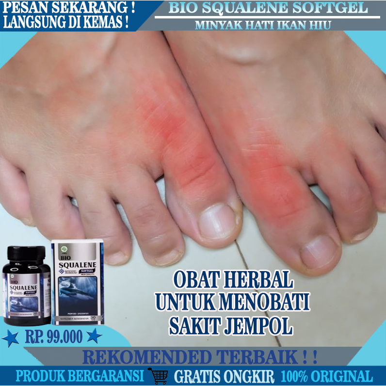 Obat Sakit Jempol Kaki & Jari Tangan, Herbal Alami Tradisional Penghilang Rasa Sakit Pada Jempol Kak