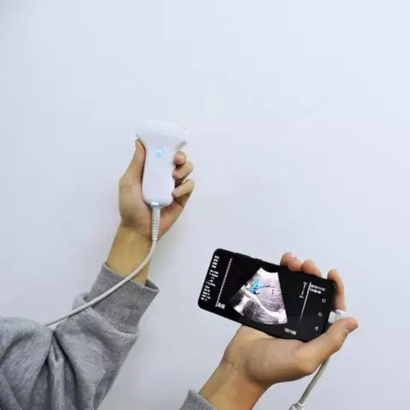 Usg android / wifi convex only