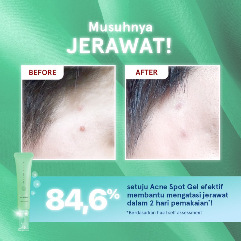 Dear Me Beauty Acne Spot Gel Obat Totol Jerawat Original BPOM COD