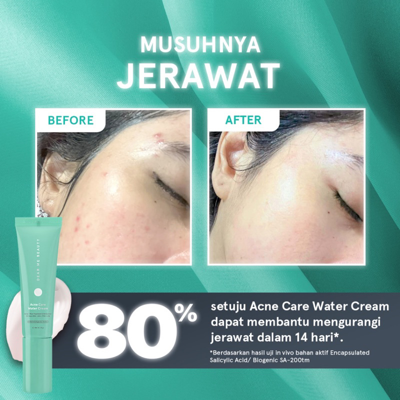 Dear Me Beauty Acne Care Water Cream Moisturizer 30gr Pelembab Original BPOM COD 30ml