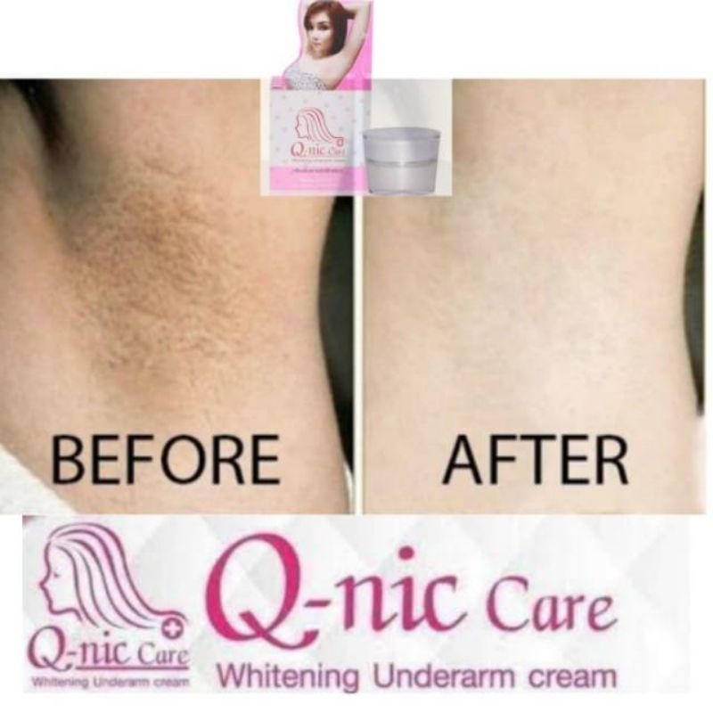 Q-nic Care 15g Krim Pemutih Ketiak Topping Balm Plus Whitening Underarm Cream 15 g