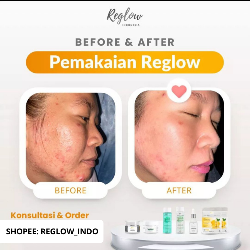 PROMO PAYDAY Reglow Night Cream + Toner Skincare Dokter Shindy Best Combo