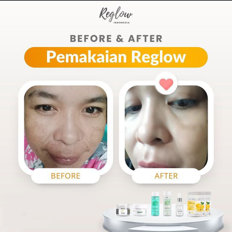 Serum Reglow dr Shindy Skincare Perfect Glowing and Whitening Serum Perawatan Kulit BPOM