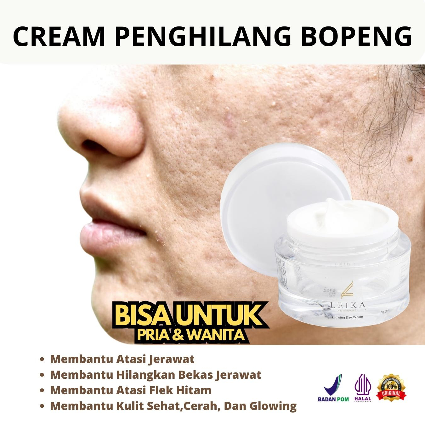 Ampuh Permanen Cream Bopeng penghilang bekas jerawat cream penghilang bekas jerawat Krim bekas jeraw