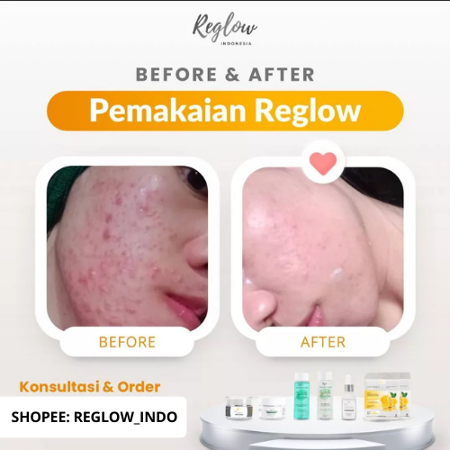 Paket Reglow Untuk Kulit Sensitif Facial Wash + Day Cream + Serum