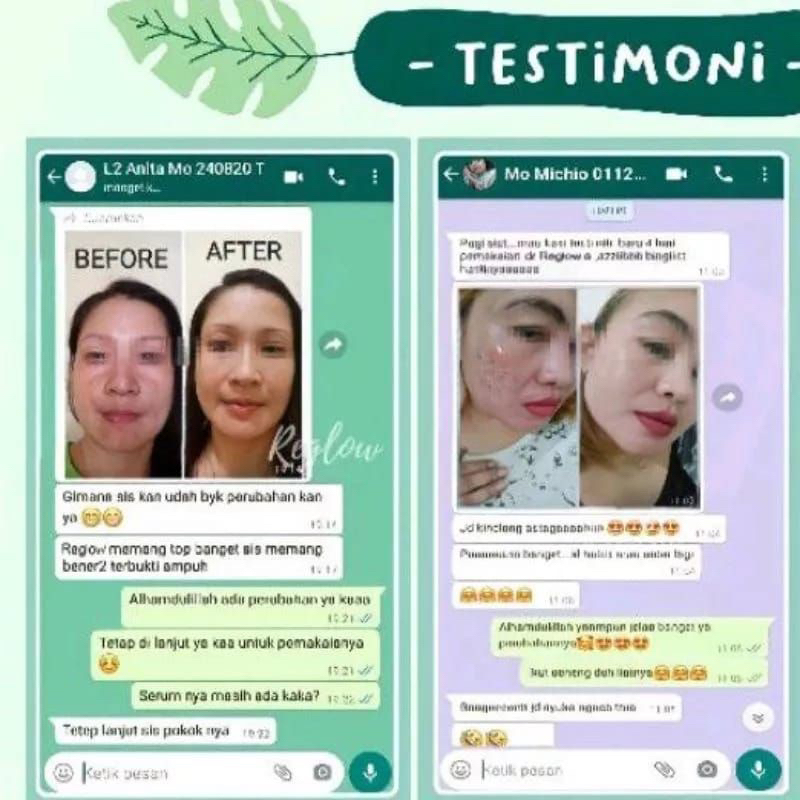 (BISA COD) PAKET REGLOW DR SHINDY SKINCARE ORIGINAL TREATMENT MENCERAHKAN