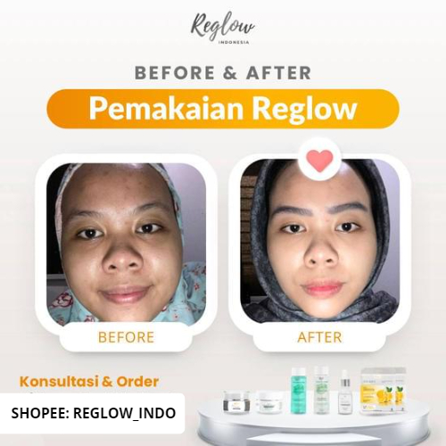 Reglow Skincare Original dr Shindy Pemutih Wajah Ori Dan Cepat Glowing Untuk Kulit Sensitif Kering Kusam Red glow Official Store