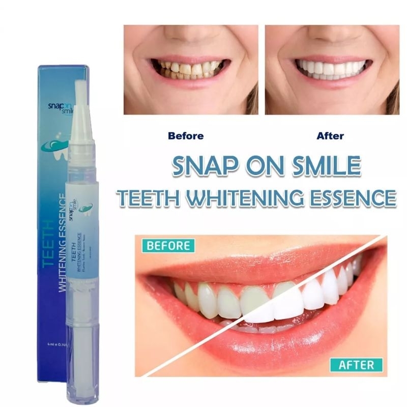 Snap On Smile Teeth Whitening Essence Pen Pemutih Gigi
