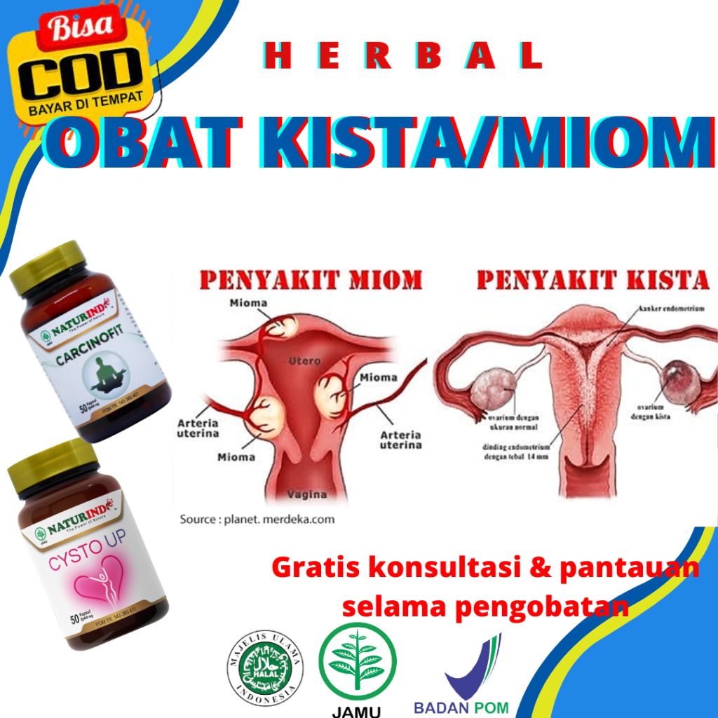 Obat Kista Ovarium Bartholin Ganglion Obat Miom Obat Kista Endometriosis Obat Herbal Kista Obat Herb