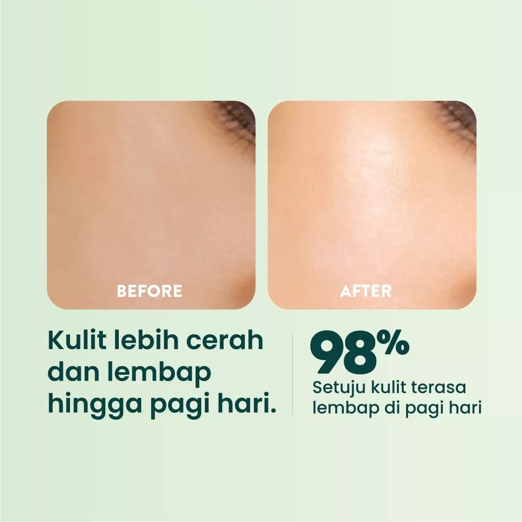 Npure Day &amp; Night Cream Centella Asiatica 15 Gram - Cica Acne Series (Krim Siang &amp; Malam) - Skincare Krim Pagi Sleeping mask Mousturizer CTMP