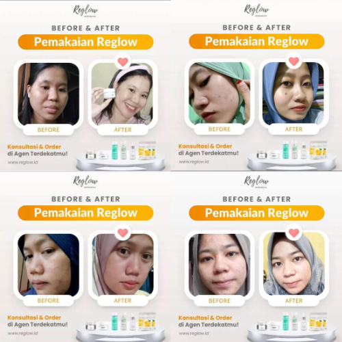 PROMO 11.11 Reglow Paket Perfect Glowing Facial Wash Day Night Cream Serum Toner dr Shindy Skincare Original Official