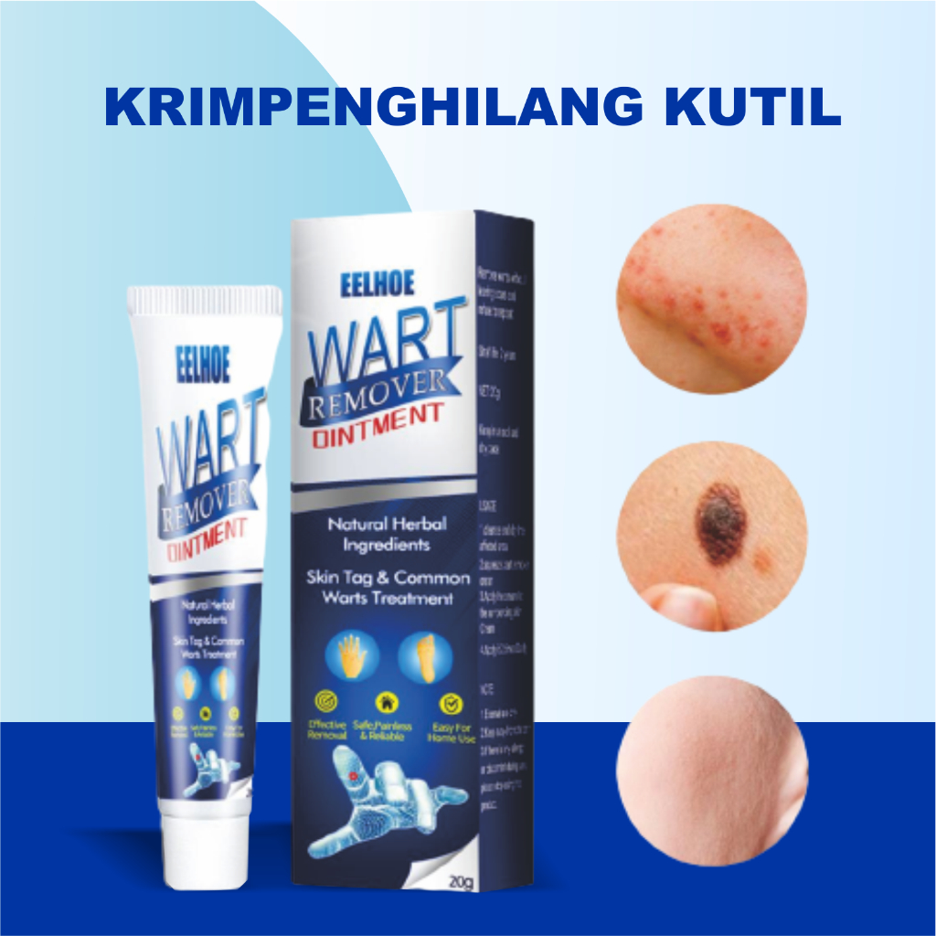 Krim Penghilang Tahi Lalat di Wajah Permanen Sumifun Wart Remover Eelhoe Wart Remover 20g
