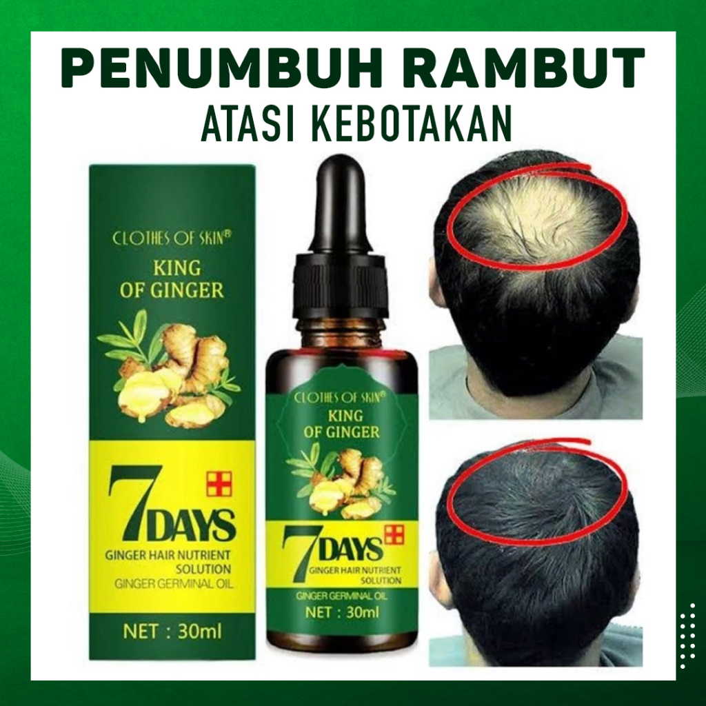 Clothes of Skin 7 Days Ginger Germinal Oil Minyak penumbuh dan perawatan Rambut Botak 30ml Penumbuh Rambut Botak