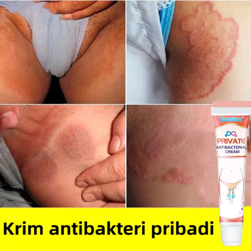 Obat Gatal Selangkangan Salep Gatal Paling Ampuh Kebersihan Kulit Menghilangkan Bau Krim Psoriasis Eczema Anti-Itching Cream selangkangan dan kelamin selangkangan dan kelamin Anti jamur obat panu kadas Salep Obat Jamur Kulit kadas selangkangan