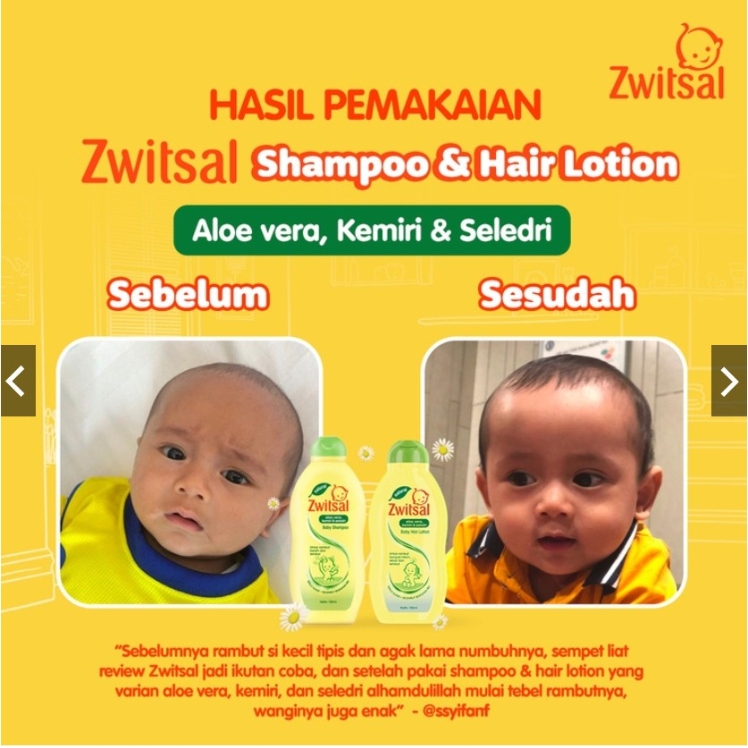 [BPOM] Zwitsal Baby Hair Lotion 100ml + 100ml / Natural Aloevera AVKS / Minyak Rambut / MY MOM