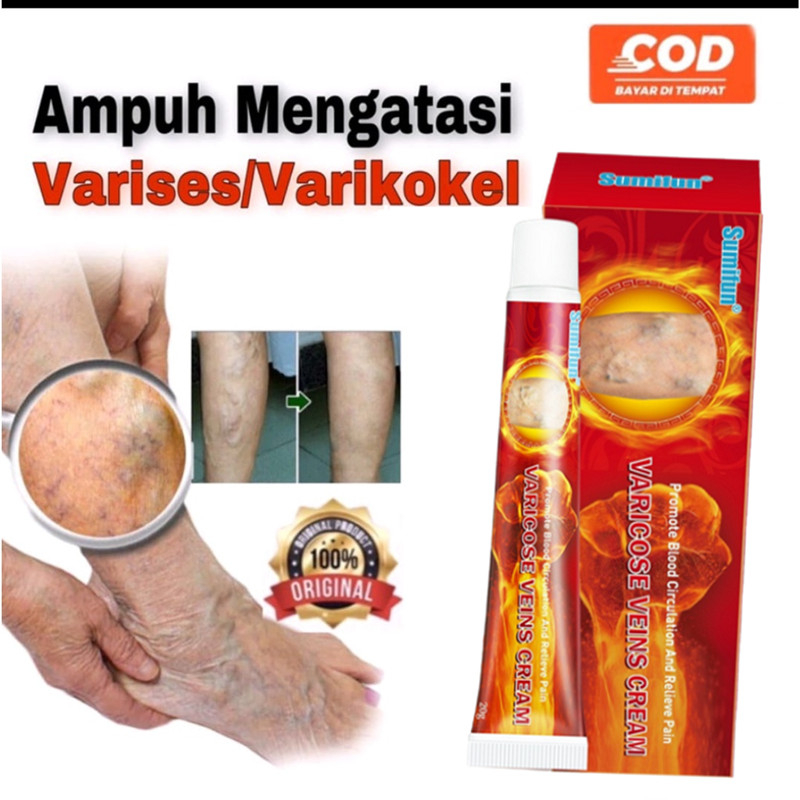 Obat Varises Di Kaki Dan Betis Paling Ampuh Obat Varises Krim Salep Penghilang Varises Varicose Vein