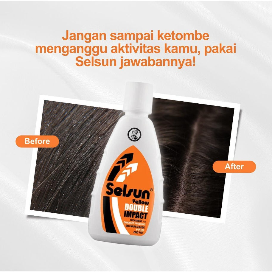 [BPOM] Selsun Yellow Double Impact Shampoo 100 ml / Selsun Shampo Anti Ketombe 100ml / Sampo / MY MOM