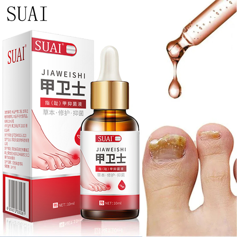 【COD】10ML SUAI Ai Armor Guards Remove Ingrown Nail Essentl Oil Nail Groove Hair Paronychia Onychomycosis Tools