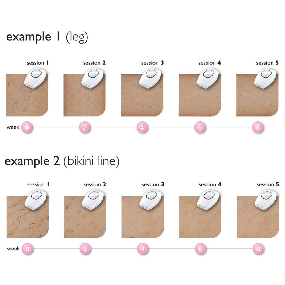 IPL Laser Hair Removal Perontok Bulu Permanent Alat Penghilang Bulu Hair Removal Tanpa Sakit alat penghilang bulu permanen menghilangkan bulu