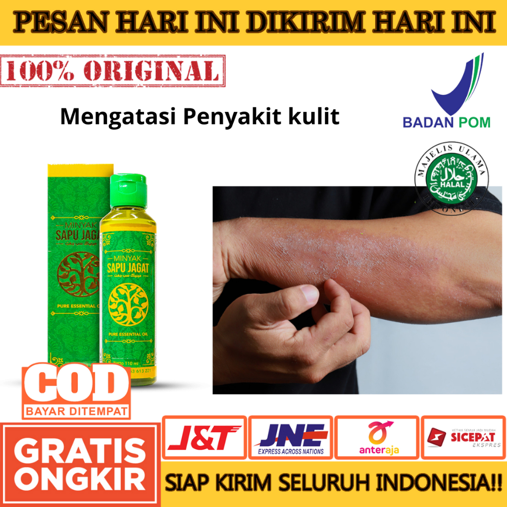 Minyak Sapu Jagat Mengatasi Benjolan Mengatasi Penyakit kulit Kaki Pegal Pegal Minyak Sapu Jagat
