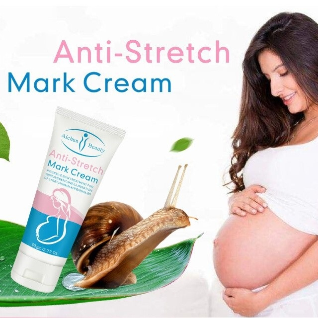 Stretch Mark Cream Anti- Stretch Mark Cream Krim Penghilang Strechmark Pasca Melahirkan Penghilang Bekas Luka 60g [100% Original]