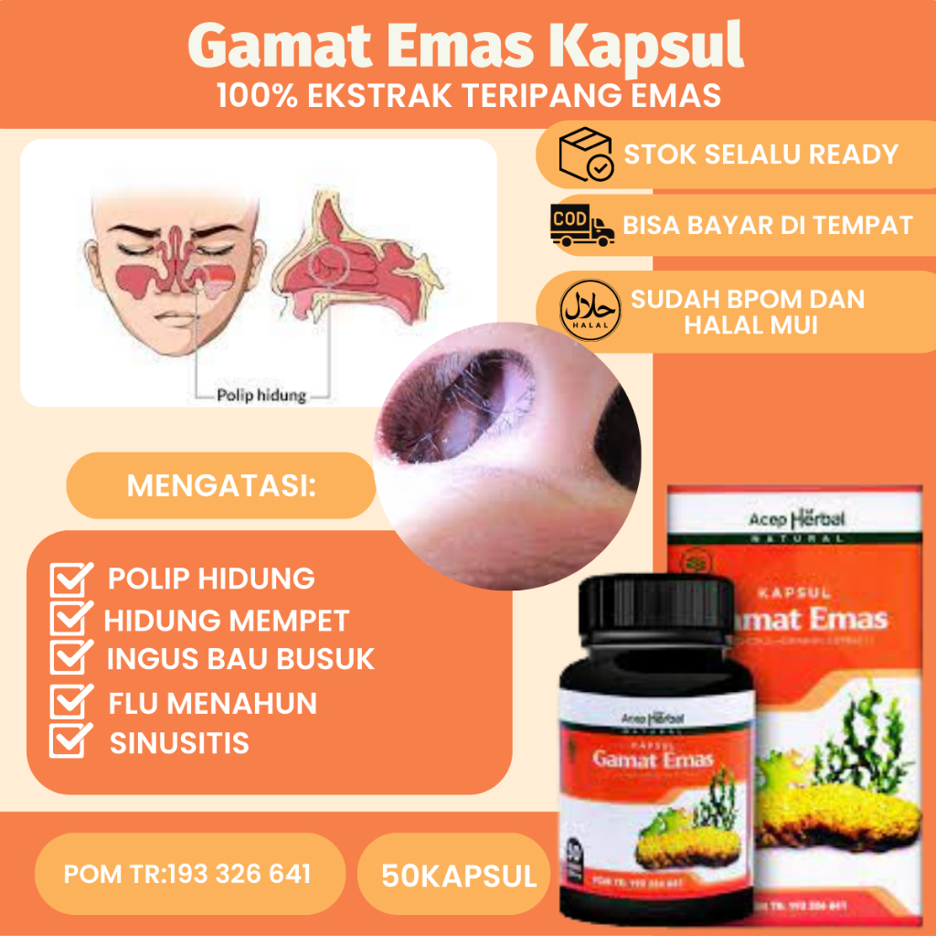Obat Polip Hidung, Sinusitis, Mengecilkan Polip Hidung, Penghilang Polip Hidung, Hidung Meler, Hidun