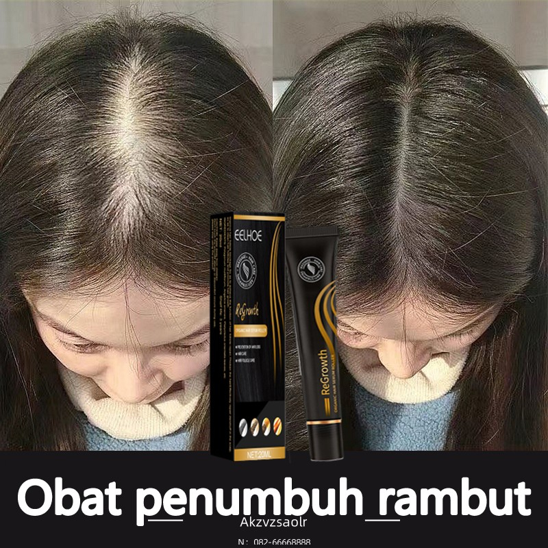 Penumbuh rambut Penumbuh rambut botak Serum penumbuh rambut Hair 20ml Serum Penumbuh Rambut Cepat  o