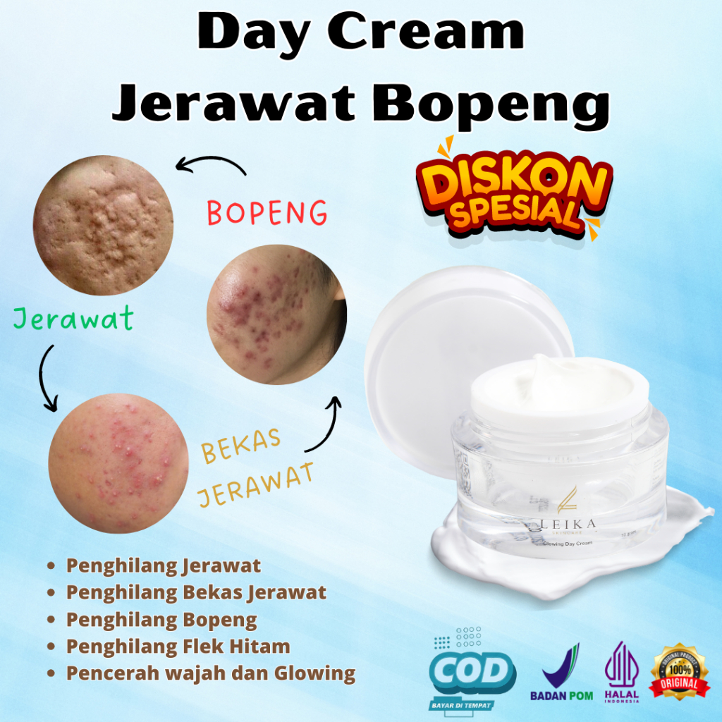 Permanen Cream Bekas Jerawat Pria Original Bpom Penghilang bekas jerawat penghilang jerawat obat jer