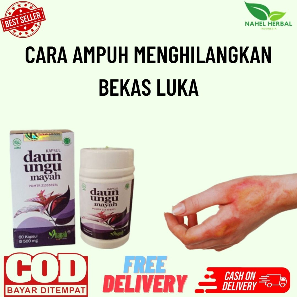 [Cod] Kapsul Ekstak Daun Ungu Original - Obat Luka/Keloid Hitam Dan Gatal Di Kaki Anak Dan Remaja Pa