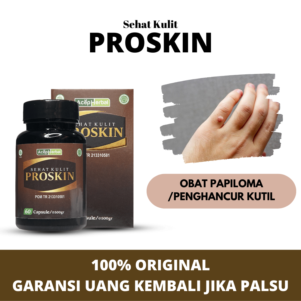 Obat Papiloma , Obat Kutil ,  Menghilangkan kutil , Penghancur kutil kelamin , Proskin kapsul sehat 