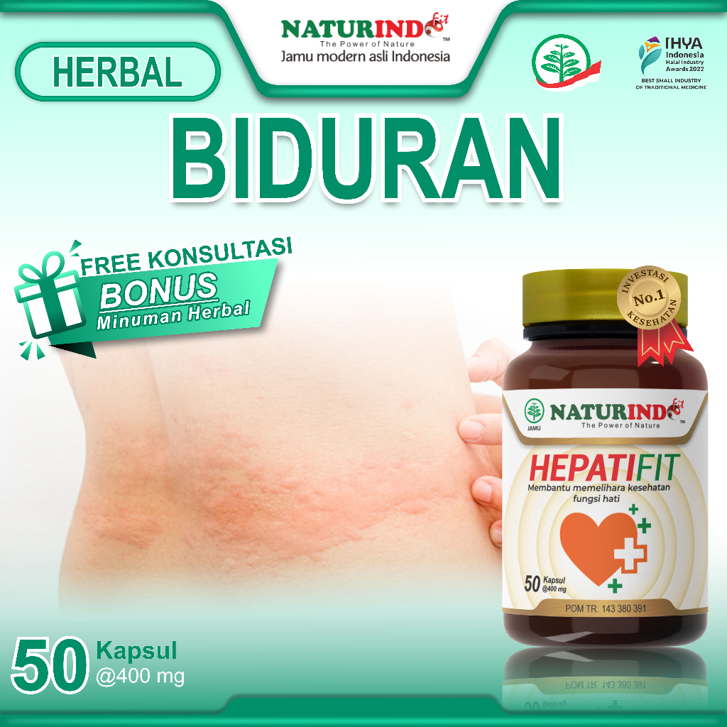 Obat Biduran Alergi Dingin Dan Panas Gatal Biang Keringat Ruam Bentol Rasa Terbakar Parah Menahun Te