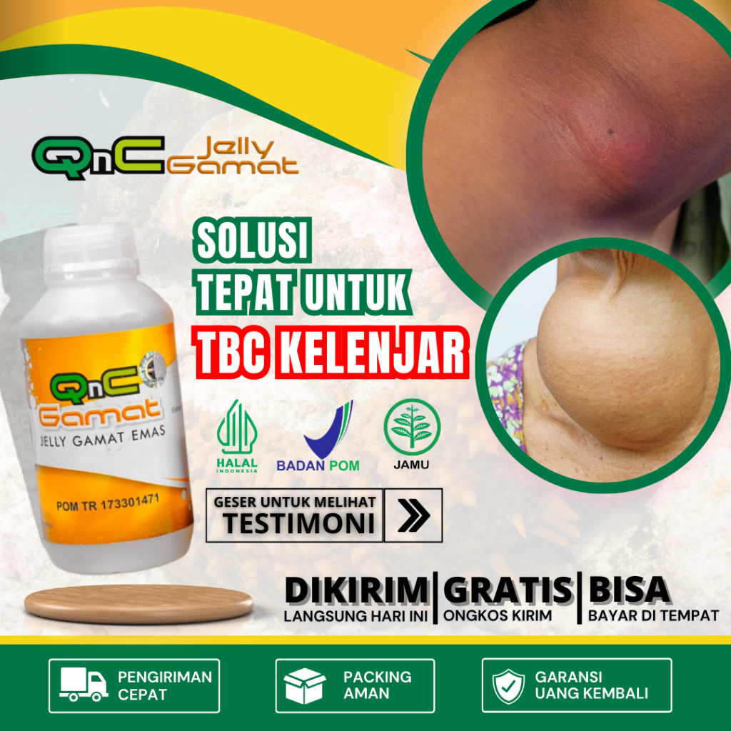 Obat TBC Kelenjar, Obat Kelenjar Getah Bening, Obat Benjolan Di Leher, Di Ketiak, Di Bawah Dagu, Oba