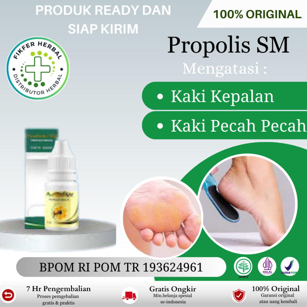 Obat Kaki Kapalan, Kulit Telapak Kaki Kering Mengeras Dan Menebal, Telapak Kaki Kapalan, Telapak Kak