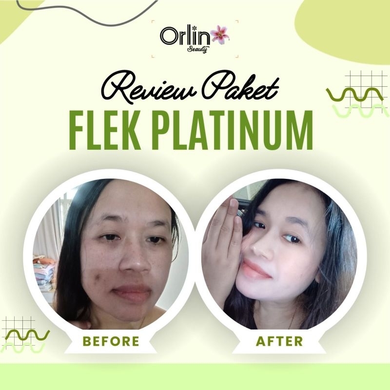 (penghilang flek tebal/skincare orlin BPOM/cream penghilang flek/