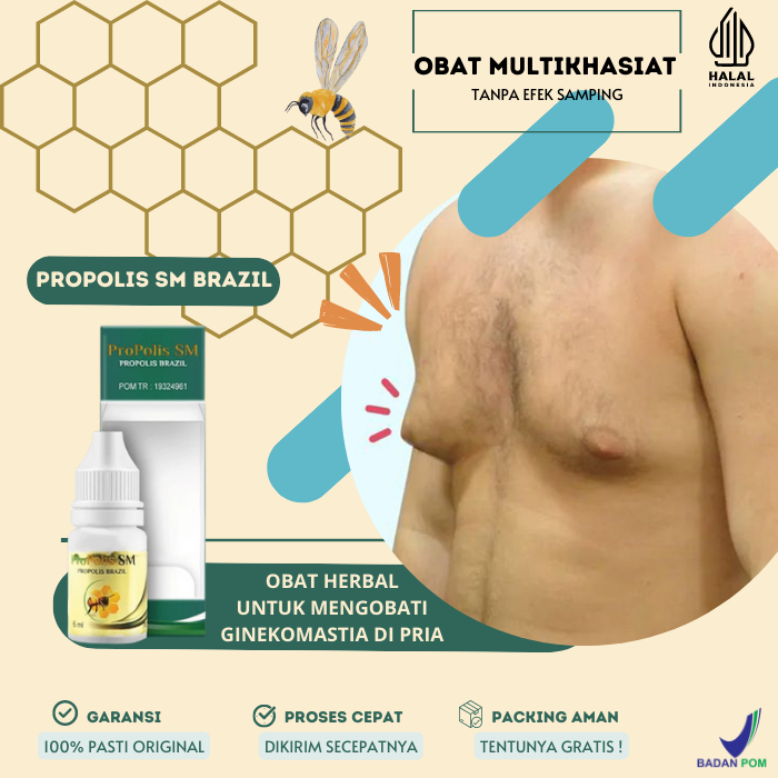 Obat Cair Penghancur Benjolan Abnormal Payudara, Obat Pencegah Ginekomastia Pria,  Obat Payudara Lak