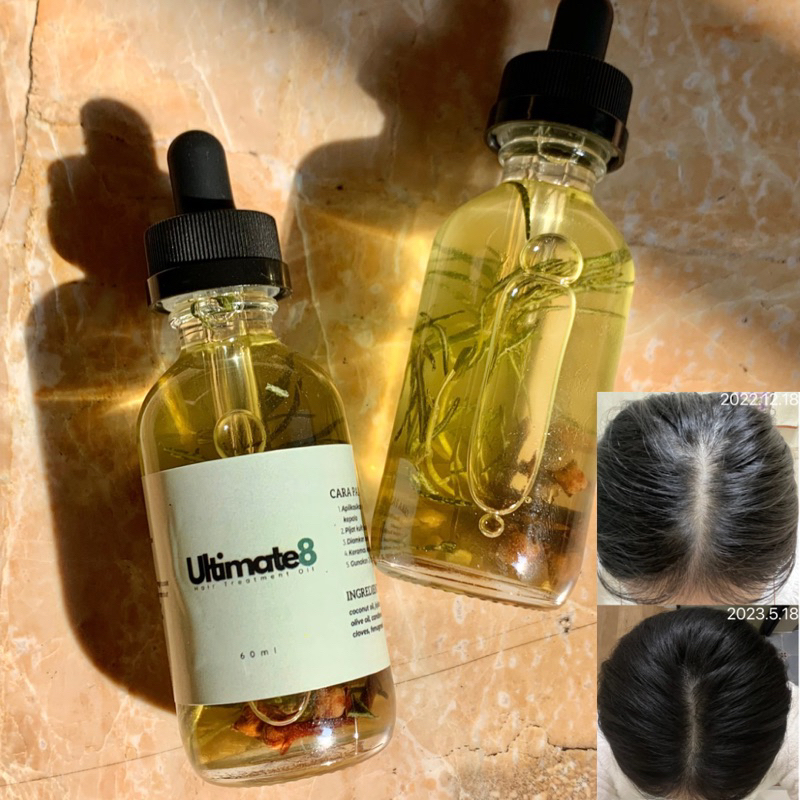 ULTIMATE8 HAIR TREATMENT OIL | ROSEMARY HAIR OIL | HAIR OIL ARAB INDIA| HAIR OIL RAMBUT RONTOK | HAI