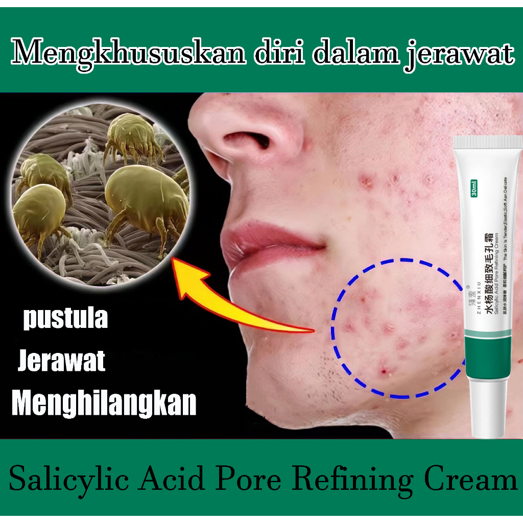 Salicylic Acid Pore Refining Cream Acne Treatment Day Cream - Night Cream 30ml Krim Jerawat Acne Spot Treatment Obat Acne Care Gel