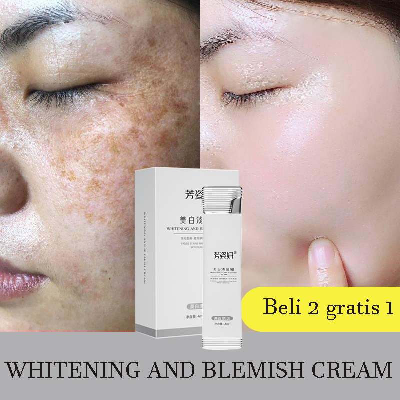 Dark Spot Serum masker freckle Brightening Anti Freckle Cream  Whitening Freckle Cream ORI Bintik menghilangkan / Chloasma / Bintik-bintik