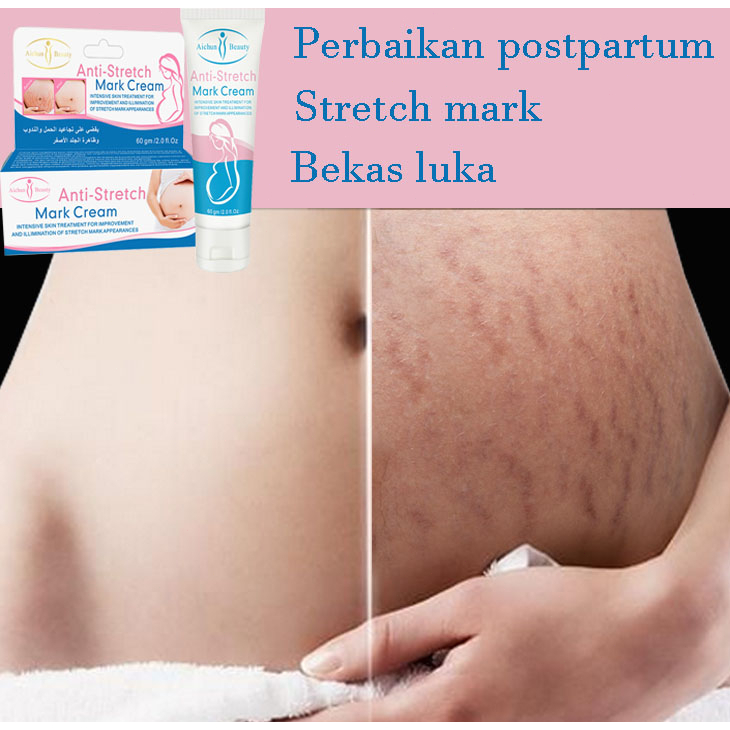 CREAM PENGHILANG STRETCH MARK Krim Stretch Mark 50G Penghilang Bekas Luka Penghilang Keloid Selulit Pregnancy Krim Anti Strechmark Aman untuk Bumil dan Busui